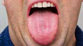 Illustration for article titled Live A Little! Press Your Tongue Against These 10 Pictures Of Tongues